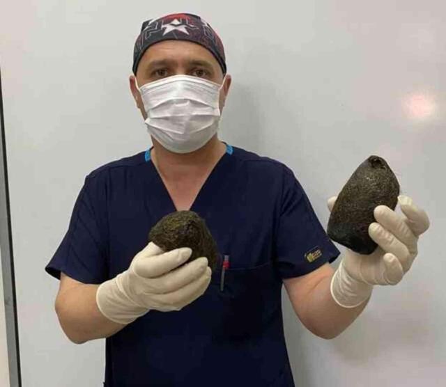 Hastanın midesinden 2 kilo saç kütlesi çıkarıldı