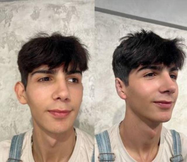 Estetikle bambaşka birine dönüşen fenomen Taha Duymaz, kulaklarını da yaptırdı! İşte son hali