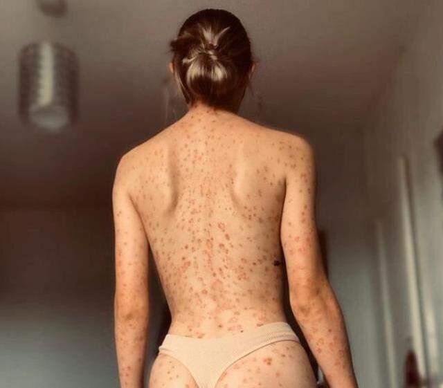 Vücudu hakkındaki sözlerden sıkılan genç kız, paylaştığı bikinili fotoğraflarla eleştirilere meydan okudu