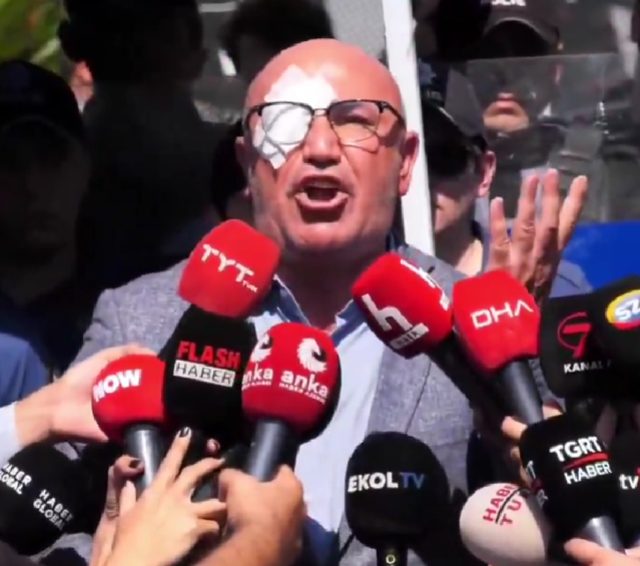 Mahmut Tanal gözü bandajlı halde polis barikatlarını yıktı