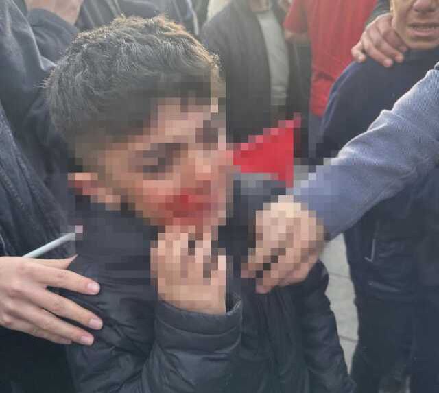 Erzurum Valisi Memiş'ten İmamoğlu'na taşlı saldırıyla ilgili açıklama: İhtiyaç olursa gözaltı yapılabilir