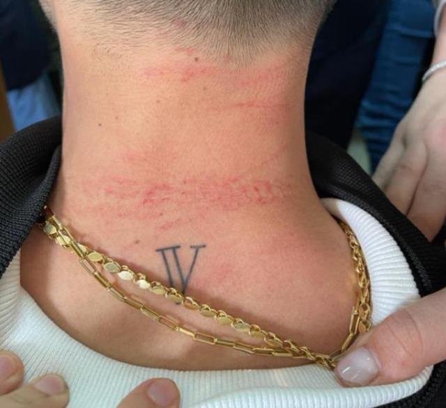 Sağlıkta şiddet bitmiyor! Gözü dönen koca, 'Karımın canını yaktın' dediği doktora saldırdı