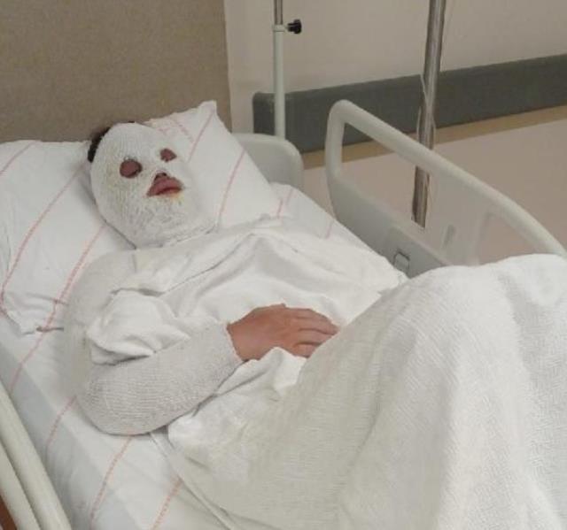 'Su sayacına bakacağız' diyerek açtırdığı kapıdan eski nişanlısının yüzüne kimyasal madde attı