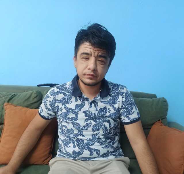 Gerçek yaşı 20 ama dünyada nadir görülen bir hastalık nedeniyle 40 gibi gösteriyor