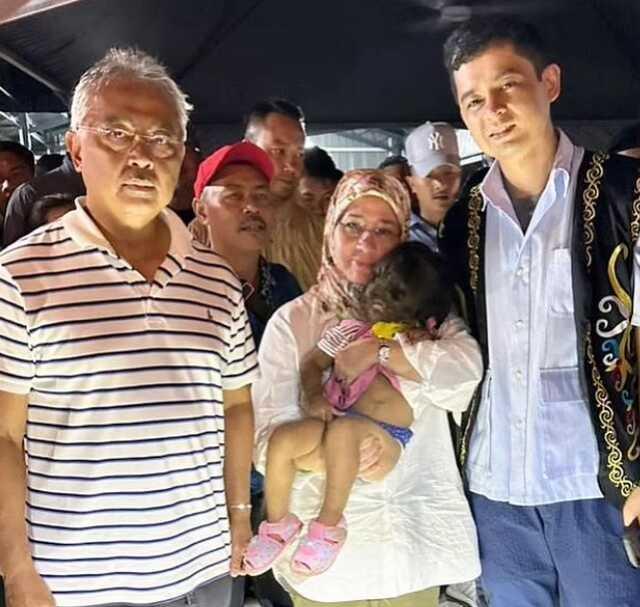 Malezya Kralı ve Kraliçesi kurt adam sendromu olan 2 yaşındaki kızı 'cennetten gelen çocuk' olarak nitelendirdi