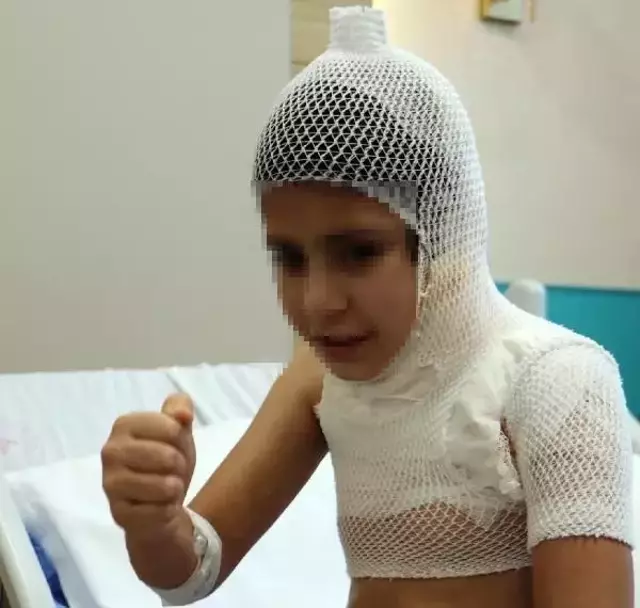 Sosyal medya trendini deneyen çocuk ağır yaralandı