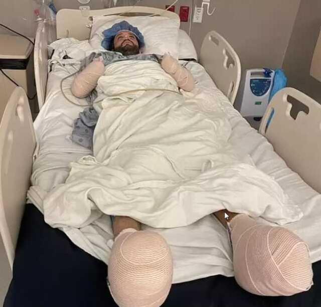 Pirenin tek bir ısırığı koca adamı yatağa düşürdü! Ellerini ve ayaklarını artık kullanamıyor