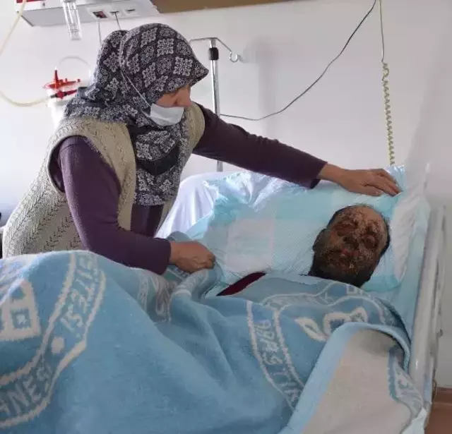 Covid-19 Geçiren Engelli Adamın Yüzü Tanınmaz Hale Geldi