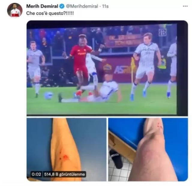 Merih Demiral çileden çıktı! Maçtan sonra yaptığı paylaşım İtalya'yı salladı