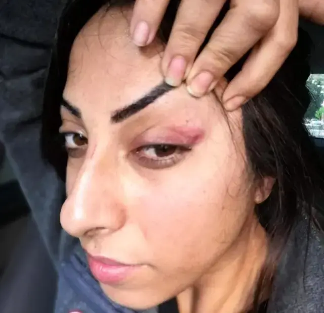 Öz annesi tarafından parayla satıldı, eşinden şiddet gördü! Saime'den yardım çığlığı