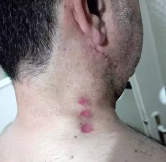 İndi bindi ücretini fazla bulan yolcu, silahını çekip taksiciyi boynundan vurdu