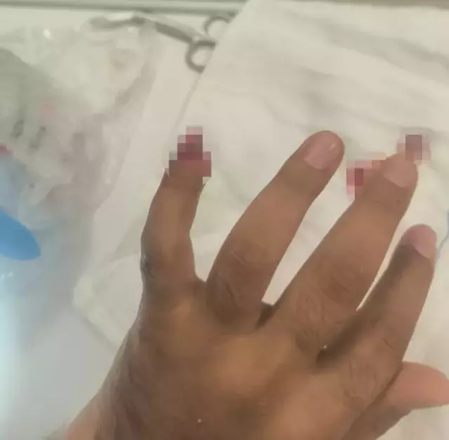 Uyuşturucu operasyonunda vahşet: Polisin parmağını ısırarak kopardı