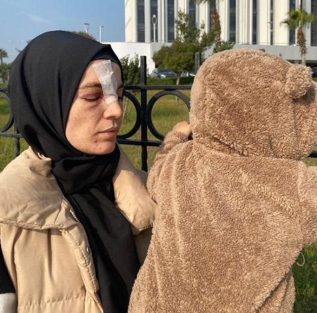 Cinsel ilişki teklifini reddedince eşinin dövdüğü kadın, korumaya alındı