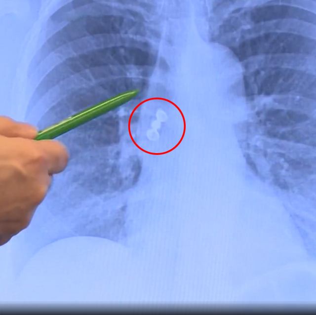 Sabah uyandığında dişleri yoktu! Doktorları bile şaşırtan gerçek hastaneye ortaya çıktı