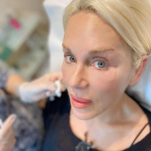 Kansere yakalanan Billur Kalkavan, hastalığı nasıl öğrendiğini anlattı