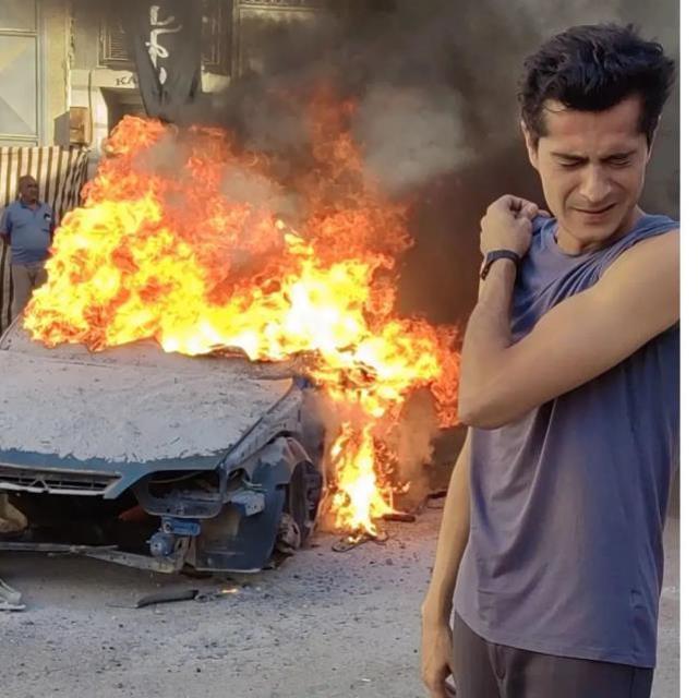 Sette korkunç kaza! Aksiyon sahnesinde kullanılan fünye İsmail Hacıoğlu'nun yüzüne patladı