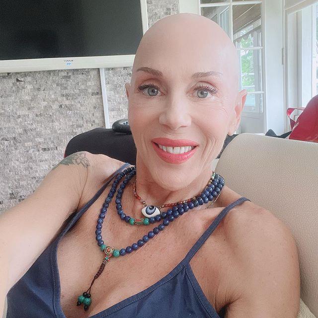 Akciğer kanseriyle mücadele eden Billur Kalkavan, son durumunu anlattı: Nefes almakta zorlanıyorum