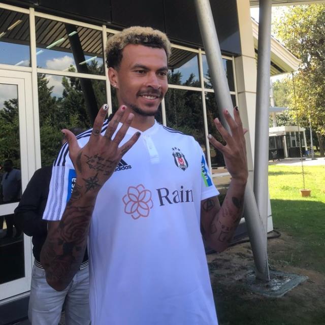 Ojeli tırnaklarıyla poz veren Batshuayi'ye Fenerbahçe taraftarından yorum yağıyor