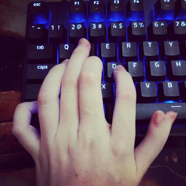 6 parmaklı Twitch yayıncısı model takipçilerini şaşırttı