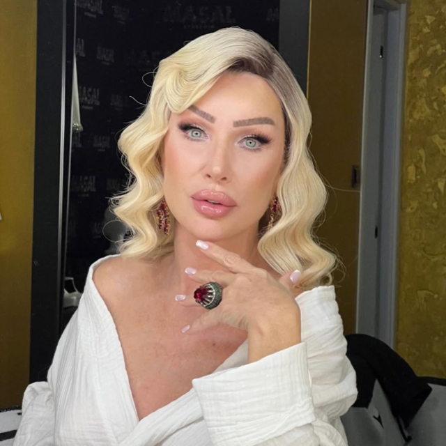 علت تورم صورت سدا سایان فاش شد