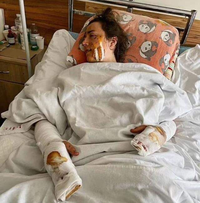 Balayında korkunç son! Yeni evli çiftin yaktığı ateş, Birinci Dünya Savaşı'ndan kalma bombayı patlattı