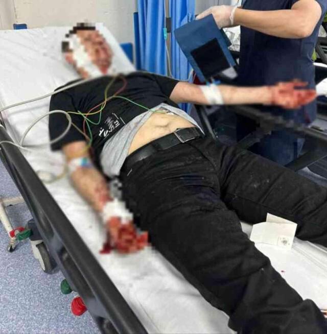 Bursa'da başıboş köpek dehşeti! Çenesi kırılan, kulağına 30 dikiş atılan baba 1,5 ay pipetle beslenecek