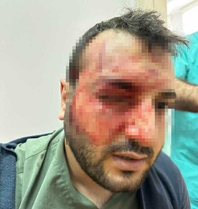 Balıkesir'de hastanede doktor kavgası! Ameliyatta başlayan tartışma kanlı bitti