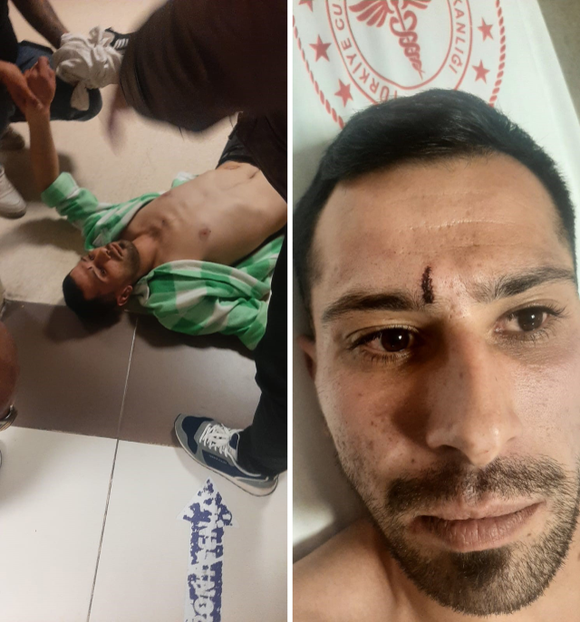 Rabia ve bozkurt işareti yaptı, dehşeti yaşadı! Belediye yöneticileri darp etti iddiası