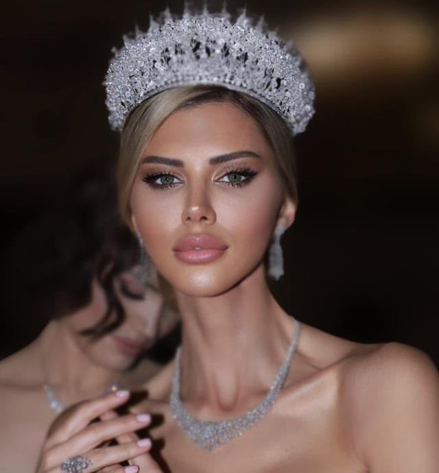 Eski Türkiye Güzeli Kanseri Yendi! İşte Son Hali