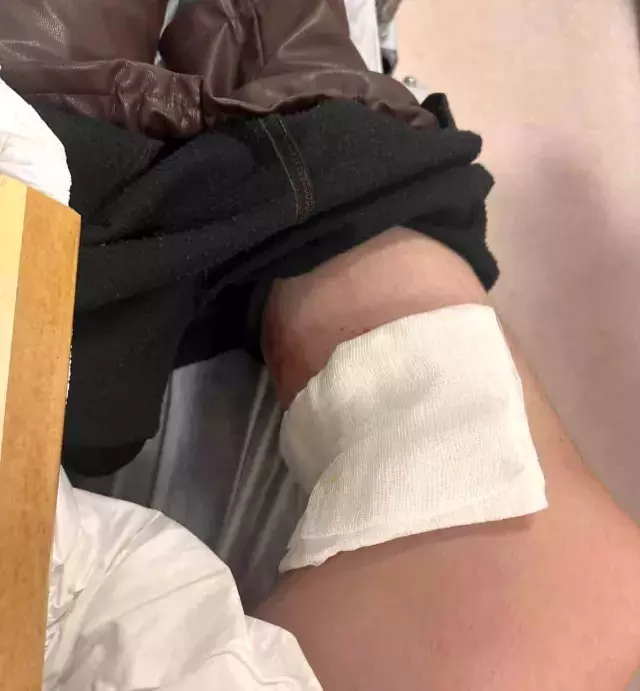 Konya'da Ziraat Mühendisi Köpek Saldırısına Uğradı