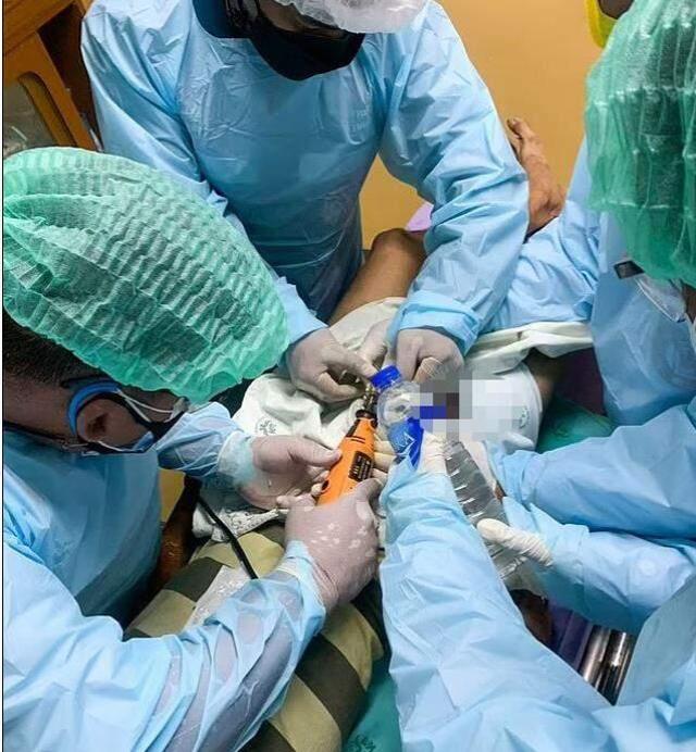 Asma kilit fantezisi hastanede bitti! Talihsiz adamın kangren olan cinsel organı kesildi