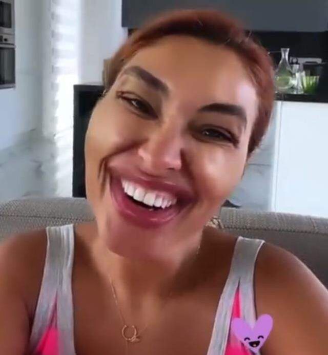 Zuhal Topal'dan botoks ve dolgu yaptırıp saklayan ünlülere esprili gönderme