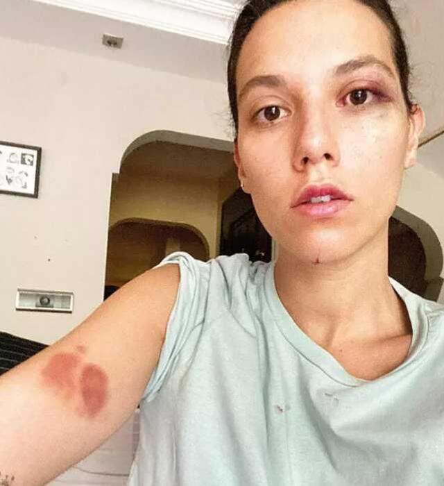 Şiddet davasında yeni gelişme! Ozan Güven cephesi kendi photoshop iddiasını boşa çıkardı: Araştırılmasın