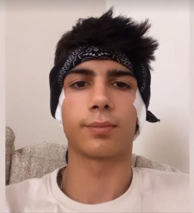 Estetikle bambaşka birine dönüşen fenomen Taha Duymaz, kulaklarını da yaptırdı! İşte son hali