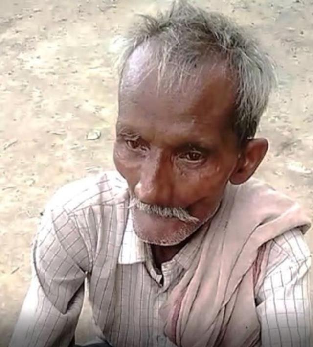 22 yıldır yıkanmayan adam sağlık kontrolünden geçti! Çıkan sonuç bir hayli ilginç