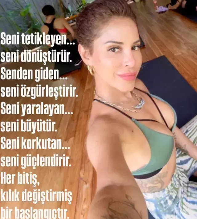 Irmak Ünal در حین مبارزه با سرطان تجربیاتش را به اشتراک گذاشت