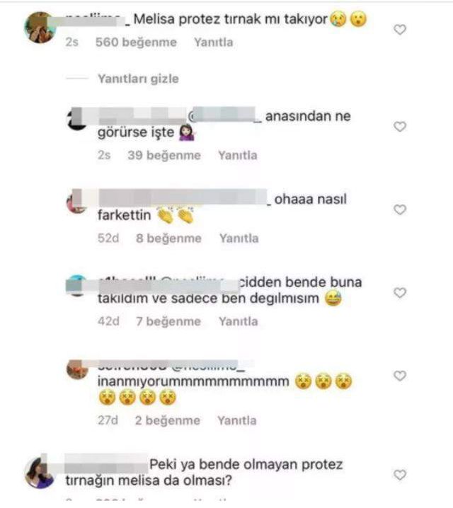 Şeyma Subaşı'nın paylaşımında Melisa detayı! 'Protez tırnakları' gündem oldu