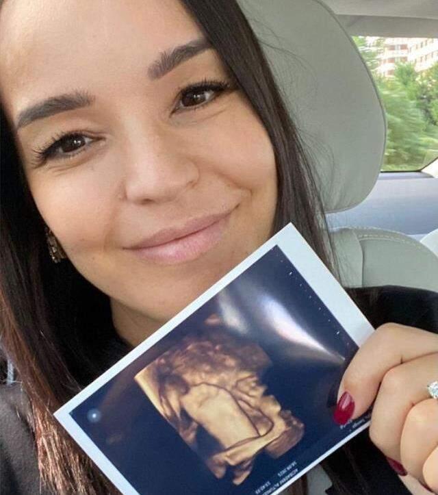 7 aylık hamile Bengü, bebeğinin ultrason görüntülerini takipçileriyle paylaştı