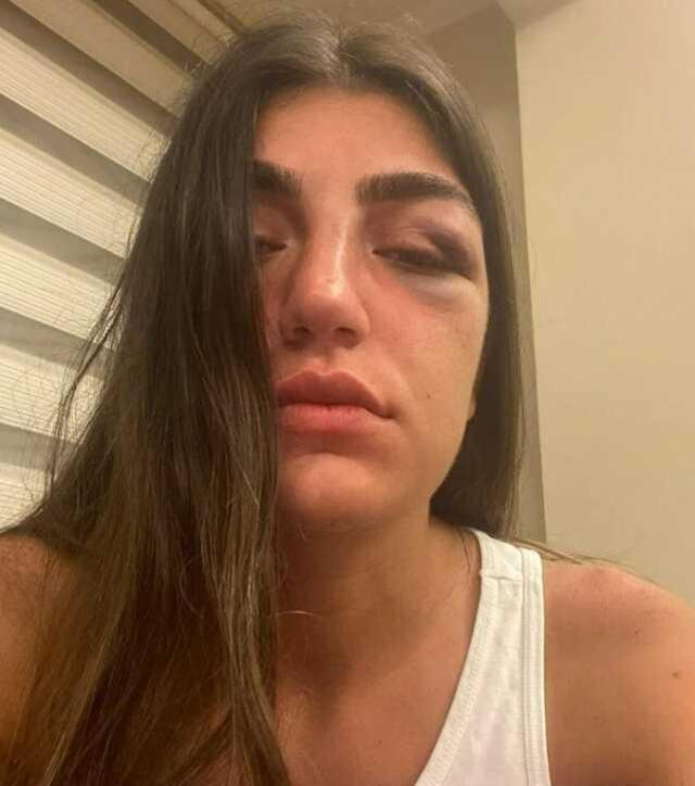 Beşiktaş'ta manken Gizem Akbaş'ın darbedilmesi davasında sanığa 7 ay 15 gün hapis cezası