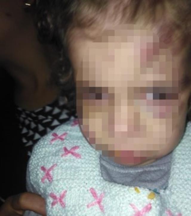 Küçük Firdevs'i darbeden anne tutuklandı, kardeşleri korumaya alındı