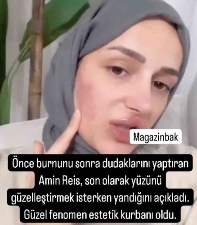 'Amin Reis' lakaplı fenomenin yüzü yandı
