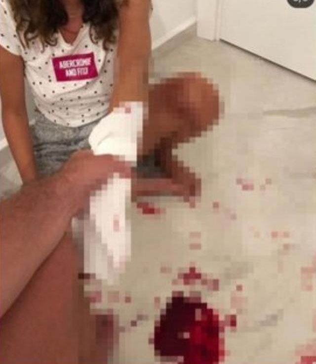 Sosyal medya gündemine damga vuran olay! Genç kadın, eski eşinin işkence anlarını paylaştı