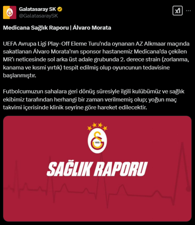 Galatasaray'ın yıldızı Fenerbahçe derbisinde yok