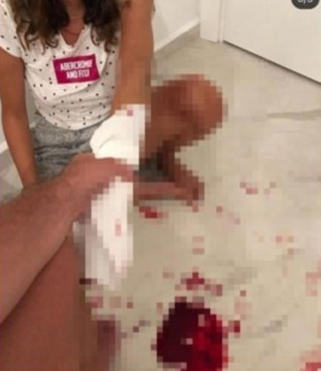 Ünlü isimler, eski eşinin şiddetine maruz kalan fenomen İrem Ay için sessiz kalmadı