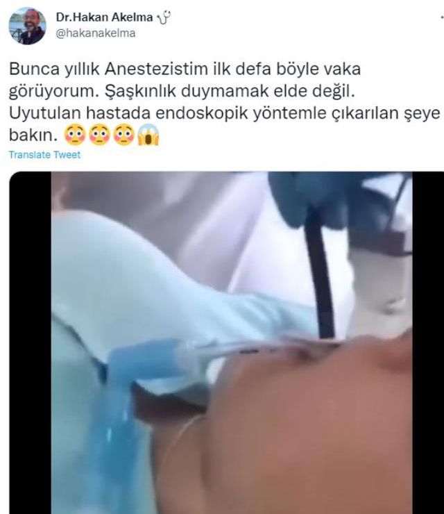 Gencin midesinden çıkarılan yılanı gören tecrübeli doktorun bile nutku tutuldu