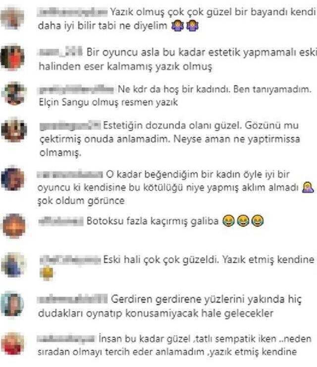 Mine Tugay estetik mi yaptırdı? Yüzünü son halini gören kullanıcılar aynı yorumu yapıyor: Güzelliğine yazık olmuş