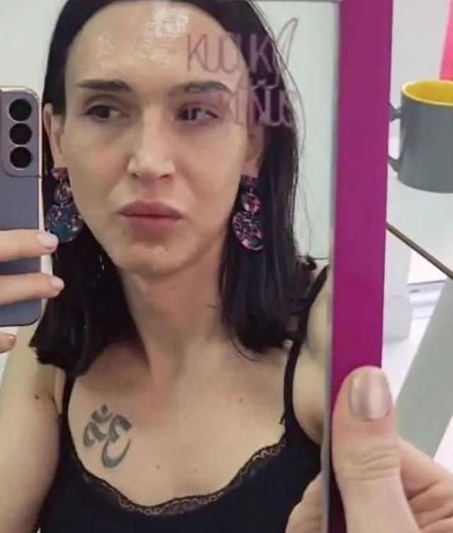 Cinsiyet değiştiren Çukur'un Timsah Celil'i bu sefer de estetik yaptırdı