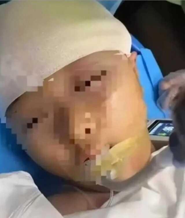 Öğretmen 9 yaşındaki öğrencisinin kafasına metal cetvelle vurarak kafatasını parçaldı