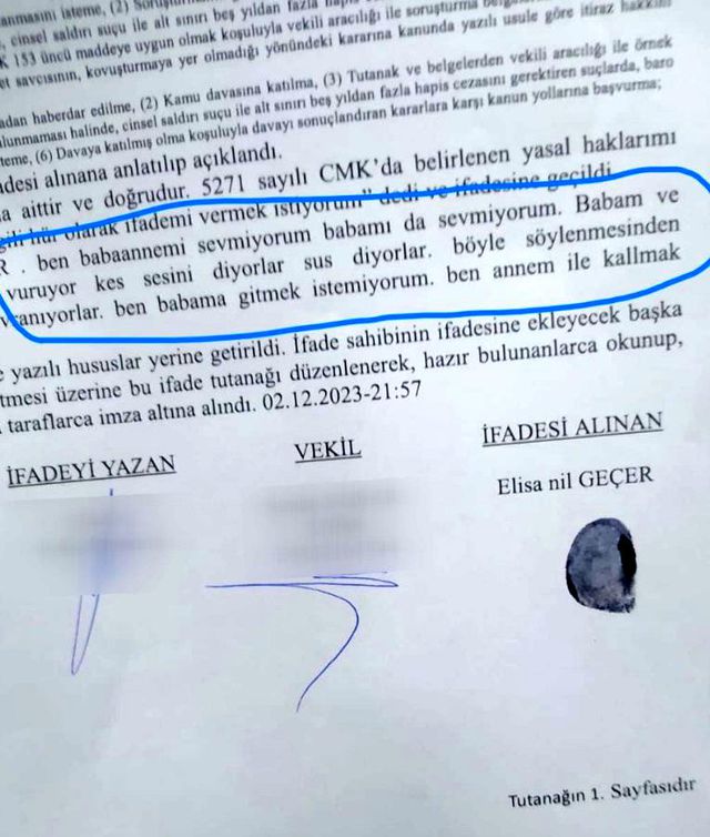 Boşanma Aşamasındaki Eş ve Kayınvalidesi Tarafından Darp Edilen Baba, Çocuğunu Göremiyor