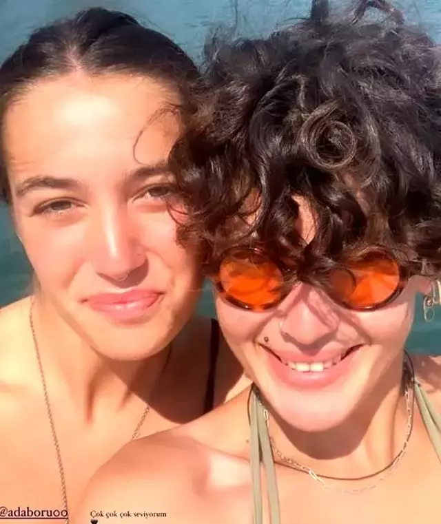 Hemcinsiyle dudak dudağa pozları olay olan Senem Kuyucuoğlu hakkında 'ameliyat' iddiası